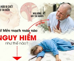 Điều Trị Di Chứng Tai Biến Mạch Máu Não, Yếu Liệt Nửa Người