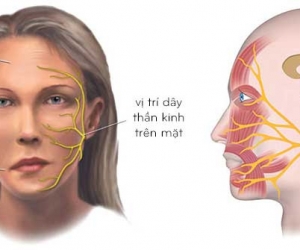 Điều Trị Liệt Thần Kinh Số 7 Ngoại Biên, Trung Ương 