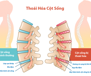 Điều Trị Các Bệnh Về Cột Sống: Chấn Thương Cột Sống, Thoái Hóa Xương Khớp...