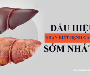 Điều trị bệnh gan